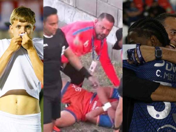 Estas fueron algunas de las mejores imágenes de los duelos entre UPNFM vs Olimpia y el Motagua vs Victoria.