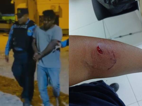 Momentos de la detención del hombre misquito por mordedura a agente policial.