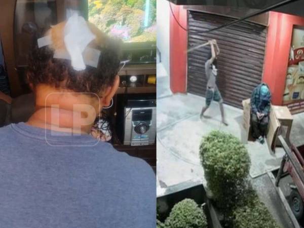 Un profundo sentimiento de injusticia embarga a Walter, un vigilante del supermercado El Rey, ubicado en La Ceiba, Atlántida, norte de Honduras, tras sufrir una brutal golpiza la madrugada del pasado jueves y que el individuo que lo golpeó se encuentre en libertad.