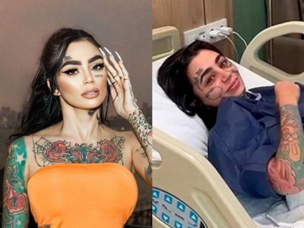 La influencer y modelo Ana Bárbara Buhr Buldrini, conocida en redes sociales como Ana B, falleció trágicamente el pasado 18 de junio mientras se sometía a una intervención estética en una clínica de Estambul, Turquía. En las últimas horas, su familia dio a conocer la noticia mediante un comunicado.