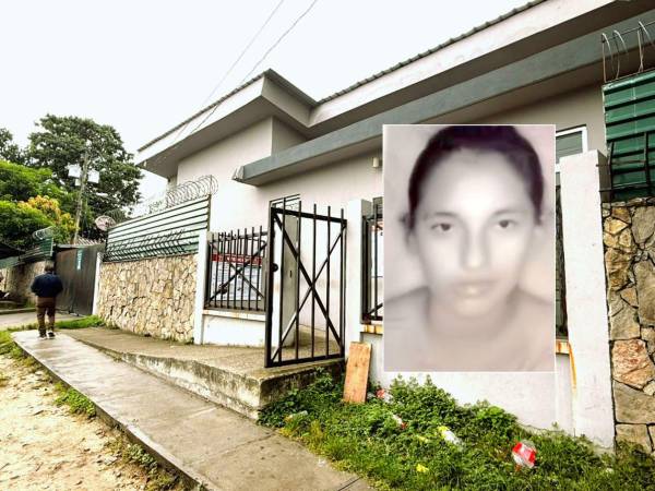 Norma Aracely Quintanilla sufrió quemaduras de cuarto grado.