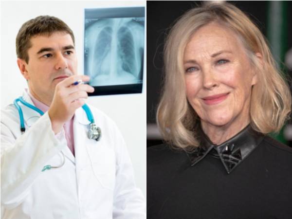Catherine O’Hara murió tras sufrir una embolia pulmonar, con cáncer rectal como enfermedad de base.