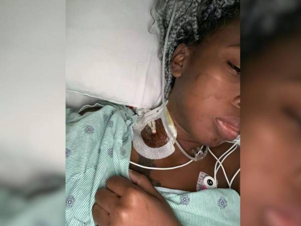 La polémica tiktoker hondureña, Lidia Arriola fue ingresada recientemente a una sala de Unidad de Cuidados Intensivos (UCI) en Estados esto para ser operada de emergencia, este es su estado de salud.