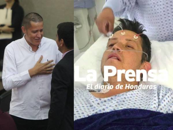 El diputado del Partido Libertad y Refundación (Libre), Octavio Morales, retomó este martes sus funciones legislativas en el Congreso Nacional, meses después de someterse a una compleja cirugía cardíaca en México, donde recibió un dispositivo de asistencia ventricular que mantiene el funcionamiento de su corazón.