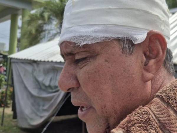 Nelson Andino denunció formalmente a su hijo por maltrato familiar, luego de agredirlo y ser atendido en el hospital Atlántida.