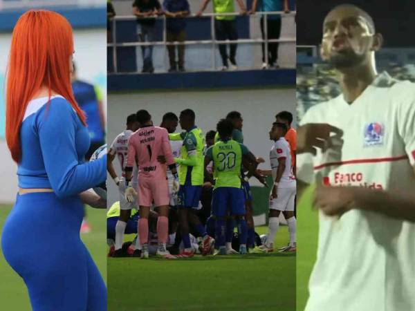 El Olimpia sufrió este sábado su primer tropiezo en el Clausura 2024. Olancho FC lo puso contra las cuerdas con un jugador menos: estas fueron las mejores imágenes del partido