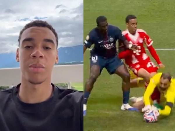 Jamal Musiala sufrió una grave lesión ante Donnarumma en los cuartos de final entre el Bayern y PSG.