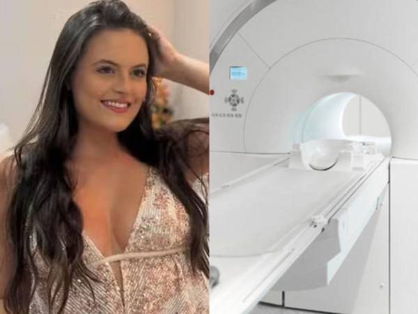 Una joven abogada falleció luego de someterse a una tomografía computarizada con contraste.