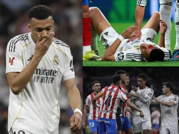 Las imágenes del empate que cedió el Real Madrid (1-1) contra el Girona en la jornada 31 de la Liga Española 2025-2026.
