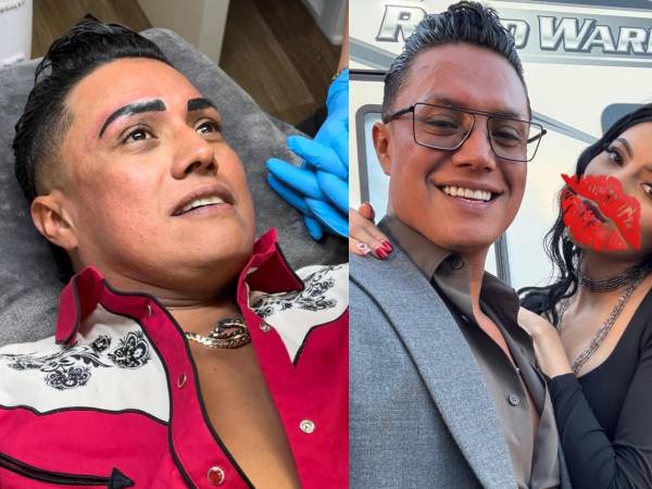 Erik Roberto, mejor conocido como El Charro o El Charrito, sigue dando de qué hablar en sus redes sociales. Y es que en las últimas semanas el creador de contenido se ha sometido a cirugías y retoques estéticos.