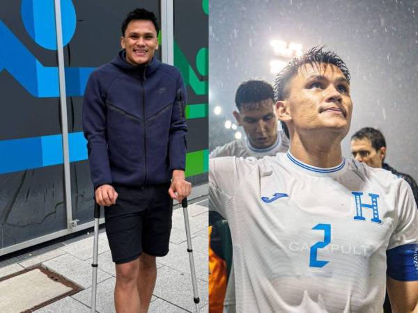 Denil Maldonado en muletas recuperandose de su lesión.