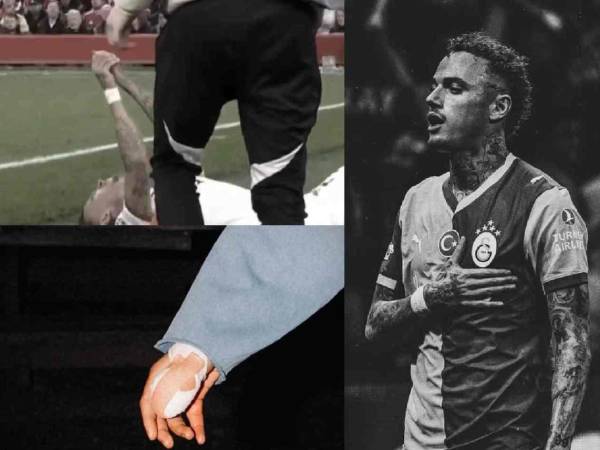 El pasado miércoles 18 de marzo se vivió un momento tenso en la Champions League. En el duelo entre el Liverpool vs Galatasaray uno de los protagonistas sufrió una inusual lesión en pleno partido.