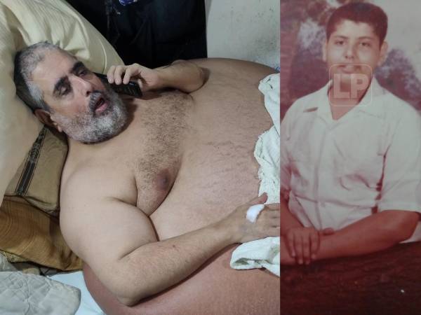 Nasser Hilsaca es un ejemplo de lucha contra la obesidad. A los 12 años era un niño delgado, pero sus hábitos alimenticios lo llevaron a convertirse en el hombre con más peso de Honduras.