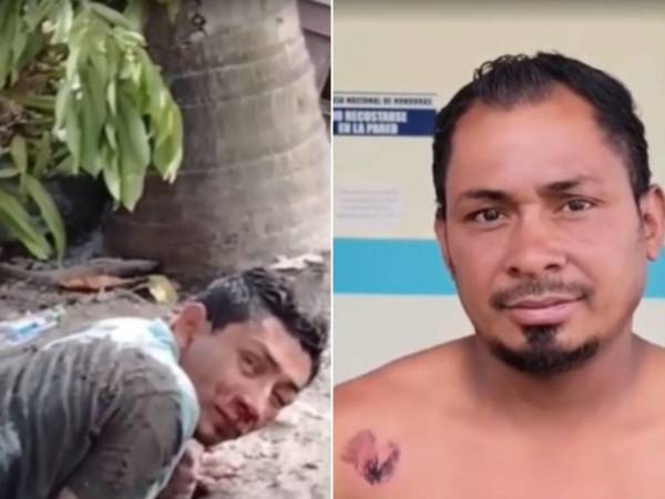 José Danilo Amador aún no logra superar el horror que vivió a las afueras de una tienda en Gualtaya, municipio de Cucuyagua, Copán.