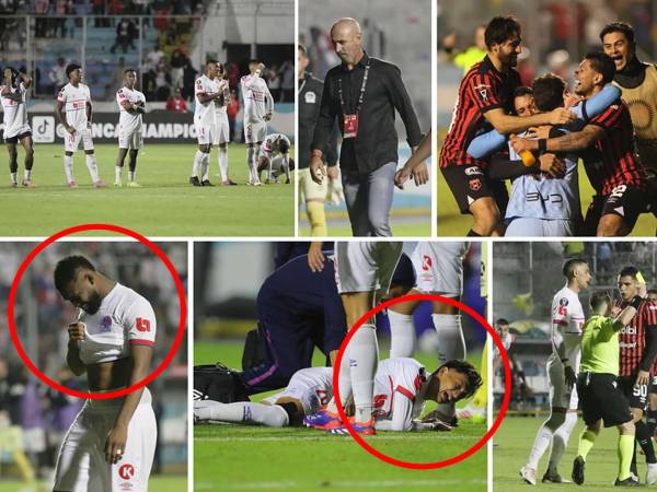 En imágenes la dolorosa eliminación del Olimpia en semifinales de la Copa Centroamericana 2025 tras perder en penales contra el Alajuelense de Costa Rica. Los merengues se quedaron sin final y terminaron llorando.