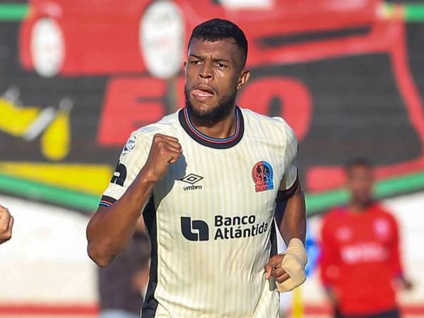 Kilmar Peña a base de sus goles ha callado muchas críticas en este inicio de temporada.