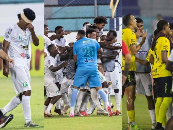 Platense y Real España regalaron un partidazo en San Pedro Sula. Los escualos y aurinegros terminaron igualando 2-2 en un partido que tuvo de todo: te mostramos las mejores imágenes del encuentro.
