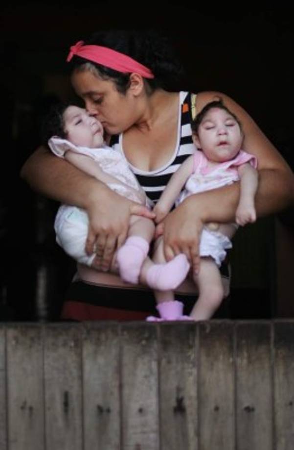 Brasil. Marcados por el zika. El Zika obligó a la Organización Mundial de la Salud (OMS) a emitir alerta mundial por contagio afectando mayormente a Brasil con 2,100 bebés con microcefalia; en Honduras también afectó registrándose este año 110 bebés con el mal congénito.