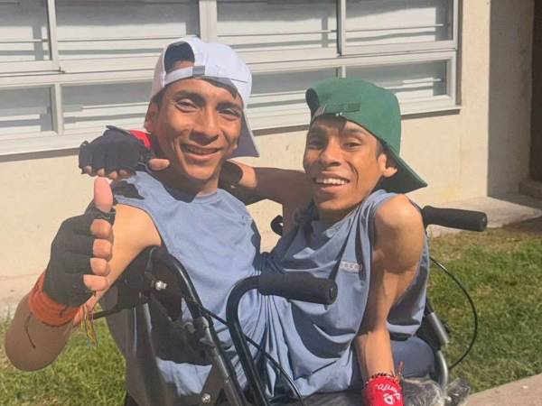 Los hermanos siameses José Luis y José Armando Cevallos Herrera, conocidos como los “siameses de Ecuador”, murieron la madrugada del jueves 15 de octubre en Colombia, donde permanecían para recibir tratamientos que les ayudaran a mejorar su movilidad.
