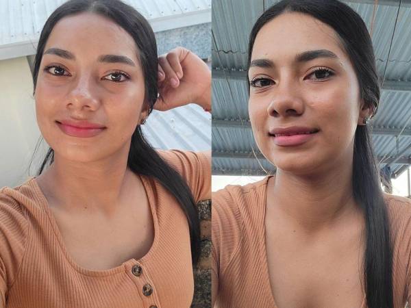 Ritzy Oviedo, de 21 años, falleció en las últimas horas en el Hospital del Sur, en Choluteca, bajo sospecha de dengue, según información proporcionada por las autoridades sanitarias.