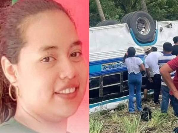 La muerte de Nora Cruz fue confirmado por familiares durante la noche del lunes, luego de permanecer hospitalizada en estado grave a consecuencia de las lesiones sufridas en el percance.