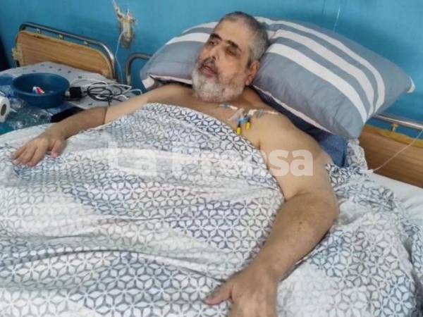 Las complicaciones derivadas de la enfermedad renal crónica y la obesidad mórbida que padecía provocaron el deterioro de la salud de Nasser Hilsaca, quien falleció este sábado 8 de agosto en el Hospital Atlántida, en La Ceiba.