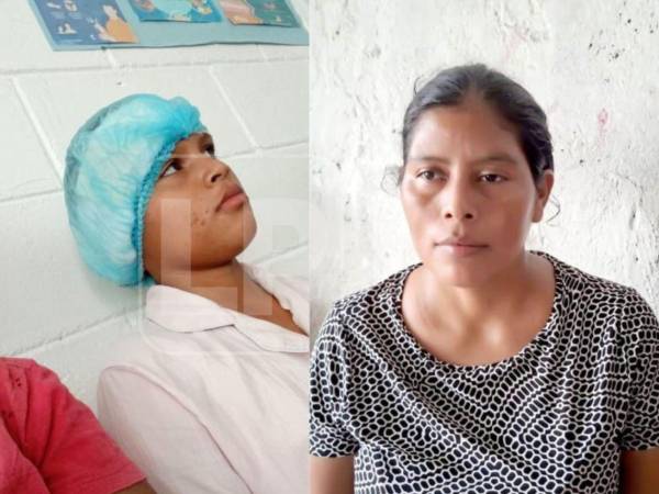 La madre indicó que el perro ya había atacado a su dueña, quien, según lamentó, no ha querido responder por los gastos que conlleva la curación de su hija.