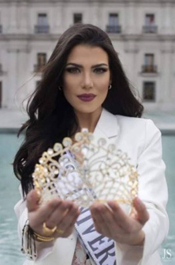 Agregó: 'Una mala práctica estética arruino mi rostro. Fui por algo rutinario y volví a mi casa devastada, con mi cara quemada con ácido. Claro que se derrumbaron todos mis sueños: Adiós novio, trabajos, modelaje y por supuesto que adiós Miss Universo... ¿Qué país querría enviar a una chica con su rostro quemado?...'