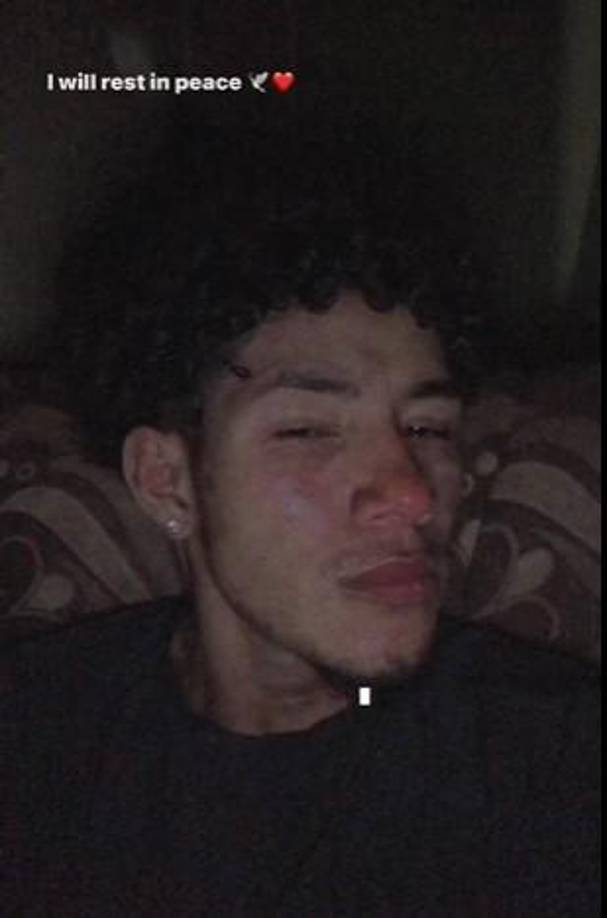 “Aunque uno vaya alumbrando el carro que viene de frente te deja ciego en esa carretera han ávido demasiados accidentes antes de que se produzca más accidente porfavor traten de alumbrar esa carretera hacia San Juan”, agregó.