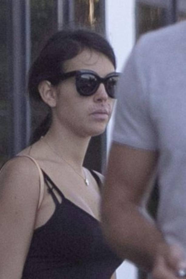 La novia de CR7 en estos momentos se encuentra con el problema del herpes. Foto Look.