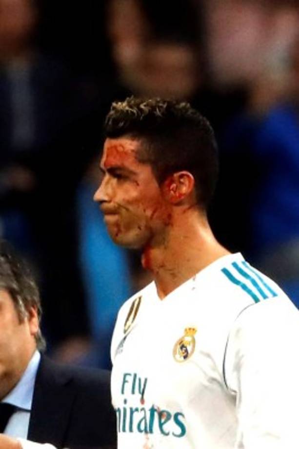 Así le quedó el rostro a CR7.
