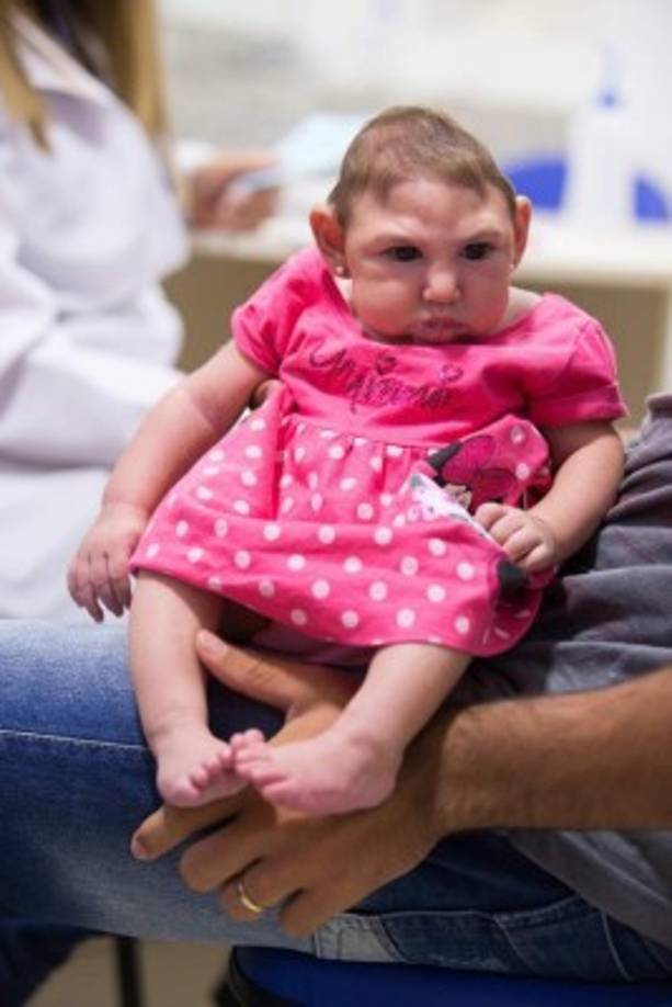 Brasil investiga desde octubre más de 3.400 casos sospechosos de microcefalia en bebés, contra un promedio de 160 casos verificados por año anteriormente.