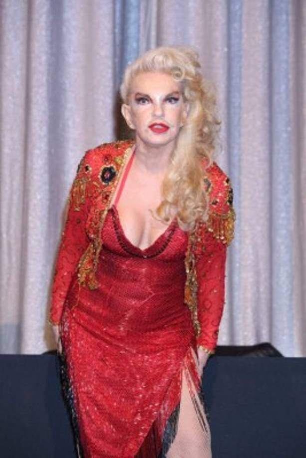 “Ella está luchando y presenta leve mejoría, como es el responder con movimientos a estímulos externos”, dijo el mexicano.<br/><br/>