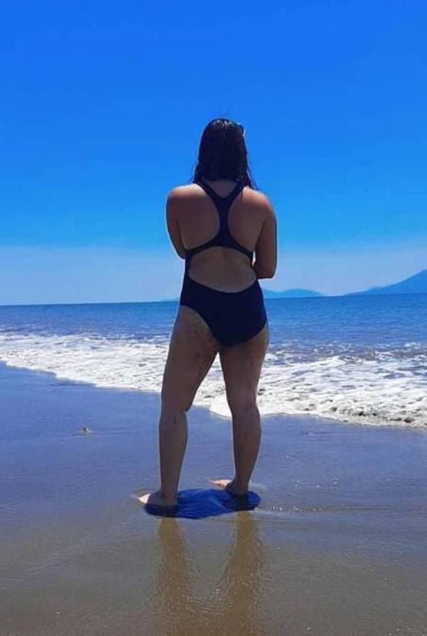 Tres días agónicos: así era Lizzy, que había sobrevivido a brutal accidente