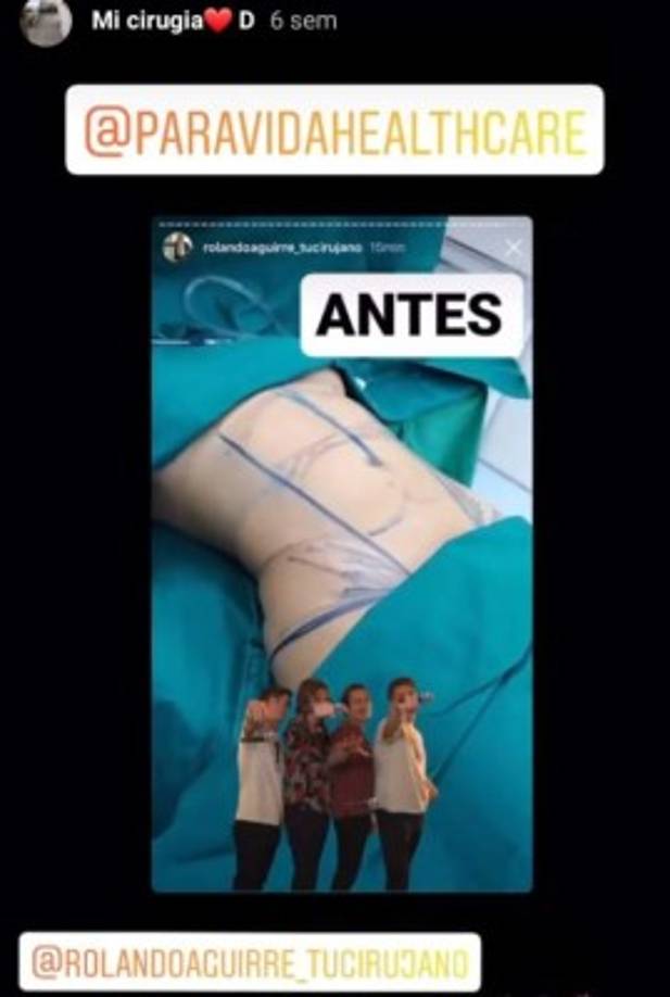 La guapa hondureña de 22 años de edad se sometió a nuevas cirugías en su cuerpo, ella dijo sentirse orgullosa de su cuerpo y de sus procedimientos quirúrgicos.