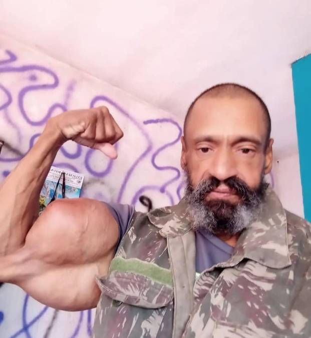 Muere el día de su cumpleaños el “Hulk brasileño”, fisicoculturista que se inyectaba aceite en sus músculos