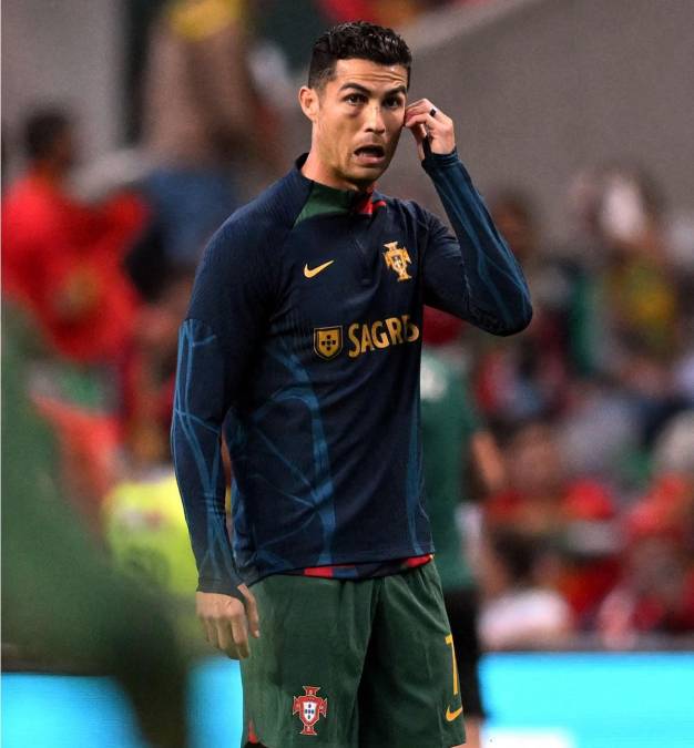 Cristiano Ronaldo presentó un moretón en su ojo derecho tras el golpe que se llevó en el duelo anterior contra República Checa.