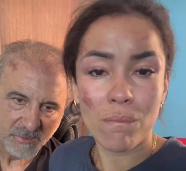 La pareja compartió un vídeo desde el hospital en el que reciben tratamiento tras el ataque. “Nos han atacado en la tienda, nos han golpeado, me han puesto un cuchillo en la garganta diciendo que nos iban a matar, y a ella la han violado siete hombres”, dijo Vicente.