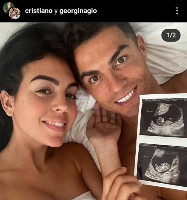Cristiano Ronaldo y su pareja, la modelo española de origen argentino Georgina Rodríguez, anunciaron en las redes sociales la pérdida de su pequeño recién nacido, mientras que una pequeña hija gemela se hallaba con vida y con buena salud.