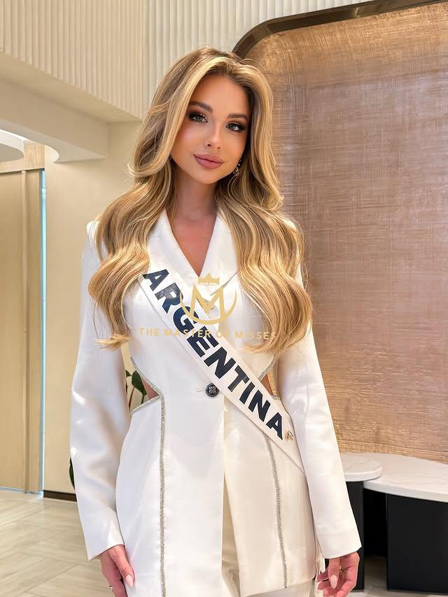 Miss Argentina 2025, Aldana Masset, revela que padece alopecia
