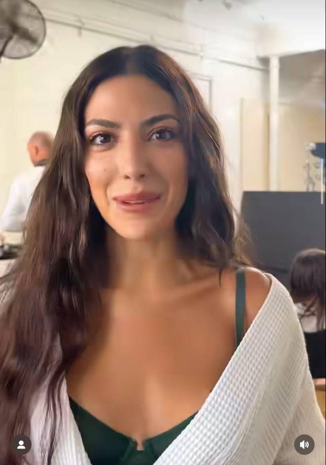 Lo cierto es que su rostro luce totalmente diferente a como lucía antes. 