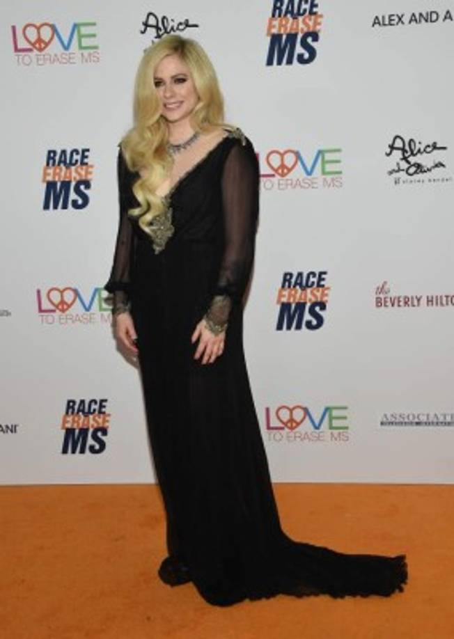 Tras recuperarse, poco a poco volvió a la música. En septiembre pasado, se presentó en el escenario por primera vez en casi tres años, uniéndose a su ex marido Chad Kroeger y su banda Nickelback para tocar su sencillo 'Rockstar' en el Greek Theatre de Los Ángeles.