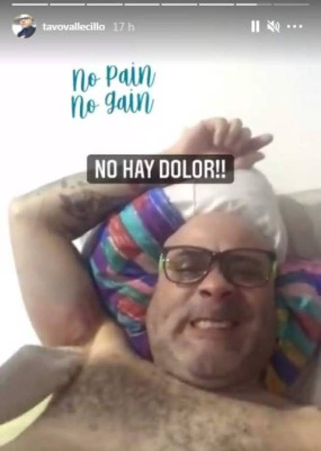 El presentador también ha compartido con sus seguidores el proceso de curación de cada una de sus heridas. El sampedrano dijo que la mordida que recibió en la zona de la axila fue una de las más dolorosas.