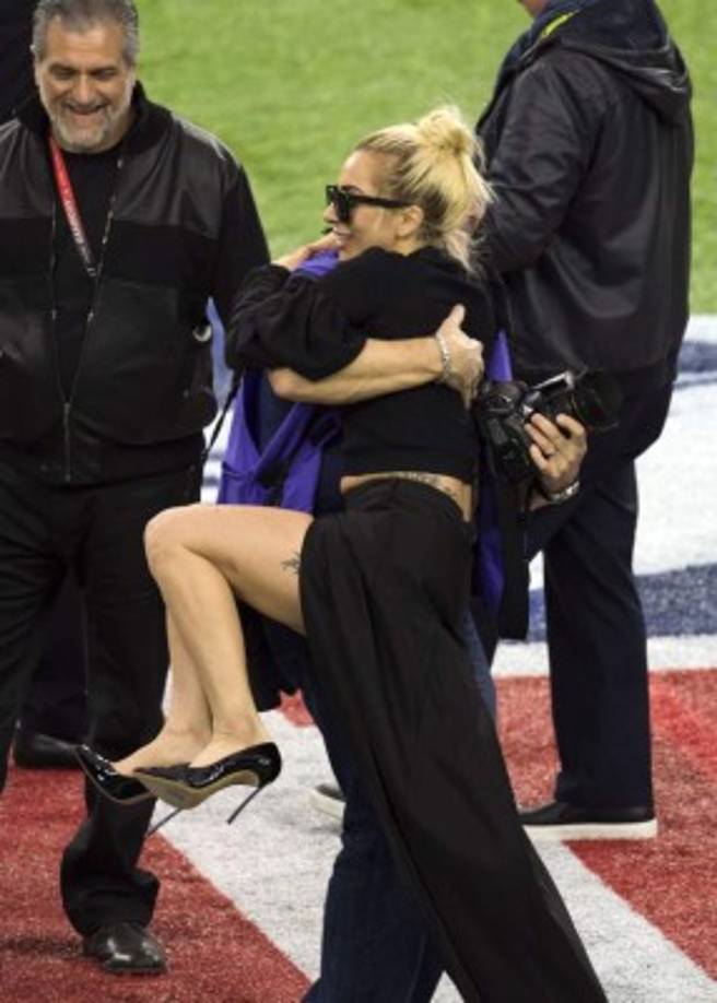 Lady Gaga mostró que tiene bellas piernas.