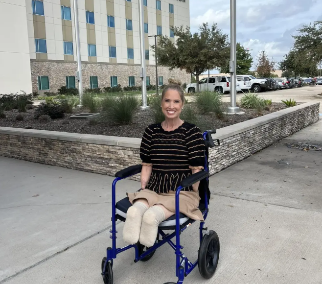 Los profesionales de la Salud recurrieron a la amputación de sus piernas por debajo de las rodillas, asimismo, de sus brazos por debajo del codo un mes después.