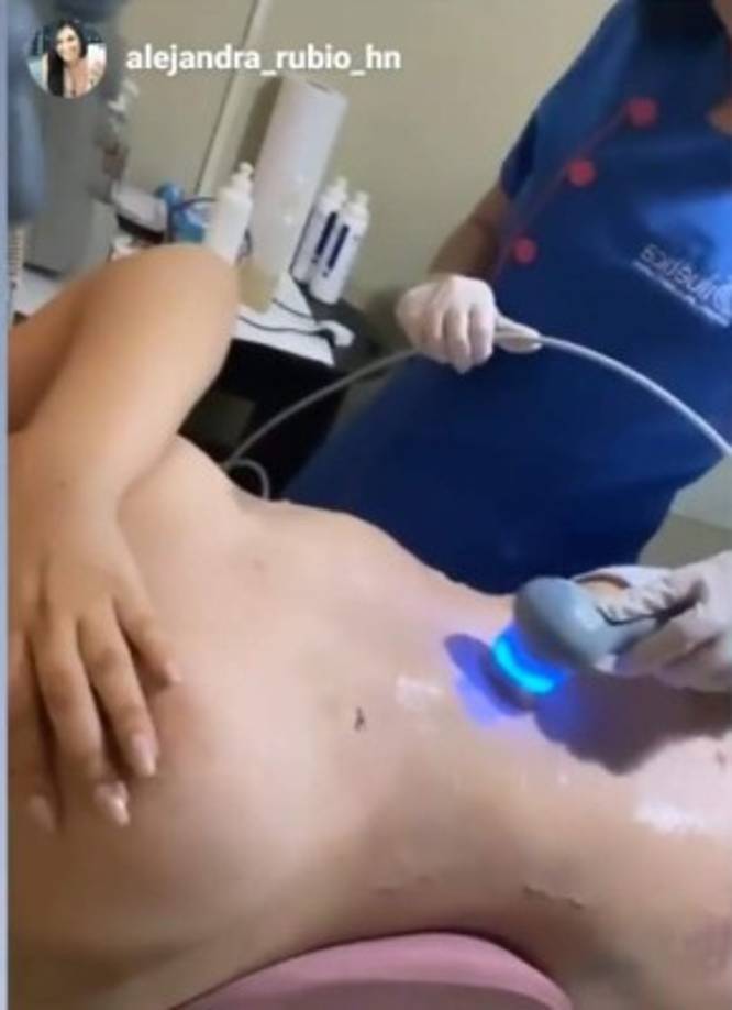 Los cuidados incluyen varios masajes para drenar los líquidos que quedaron en su cuerpo.