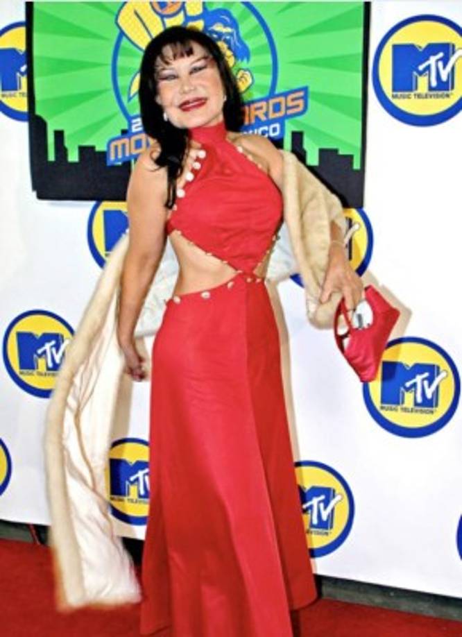 Para 2003 sorprendió con los primeros efectos colaterales de la mala praxis que sufrió.