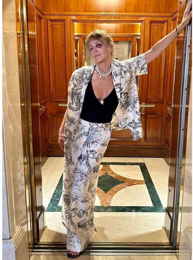 Esta es la fotografía que está dando de qué hablar en redes sociales, en referencia al golpe que sufrió Sharon Stone.