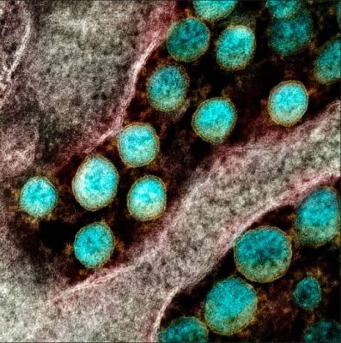 Las imágenes publicadas por NIAID ilustran al SARS-CoV-2 (más conocido como coronavirus, y el responsable de la inédita pandemia global ) colonizando una célula humana.