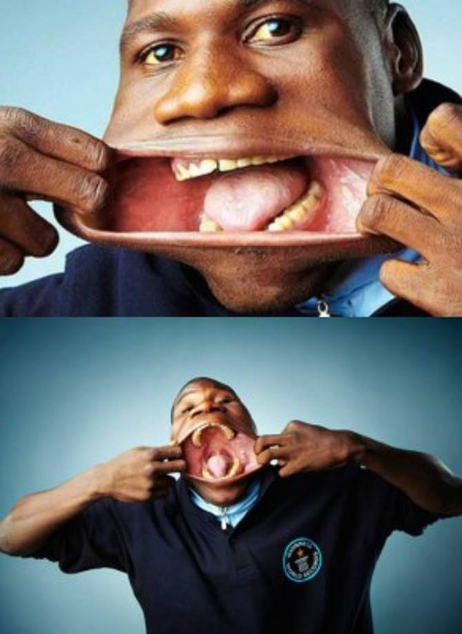 Boca más ancha - sin estirar<br/><br/>La boca más ancha mide 17 cm y pertenece a Francisco Domingo Joaquim 'Chiquinho' (Angola).<br/><br/>Fue medido en el set de Lo Show dei Record en Roma, Italia, el 18 de marzo de 2010.<br/>